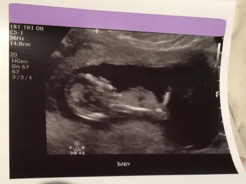 my new brother or sister